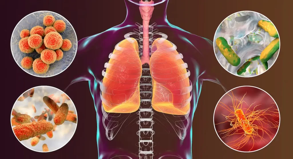 healthcare associated infections meaning (HAIs)